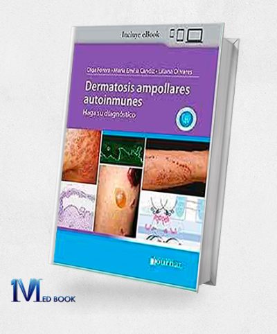 Dermatosis ampollares autoinmunes Haga su diagnóstico (High Quality Image PDF)