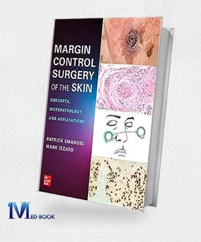 Margin Control Surgery of the Skin Concepts Histopathology and Applications (EPUB)