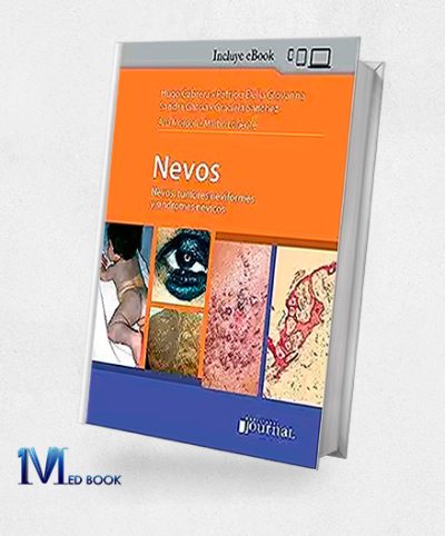 Nevos Tumores Neviformes y Sindromes Nevicos (Spanish Edition) (High Quality Image PDF)