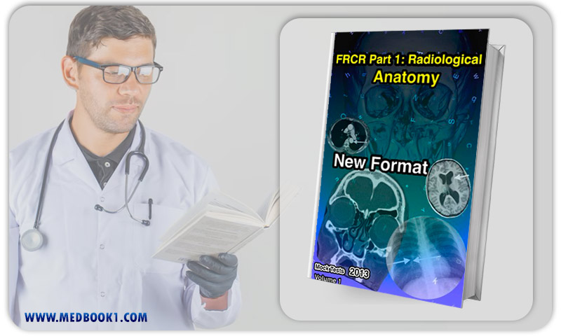 FRCR Part 1 Radiological Anatomy New Format (Mock Tests 2013) Volume 1 (EPUB)
