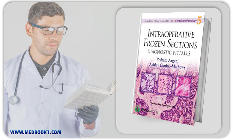 Intraoperative Frozen Sections Diagnostic Pitfalls (Consultant Pathology) (Original PDF from Publisher)