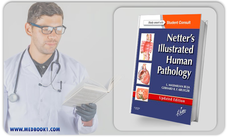 Netters Illustrated Human Pathology Updated Edition (Original PDF from Publisher)