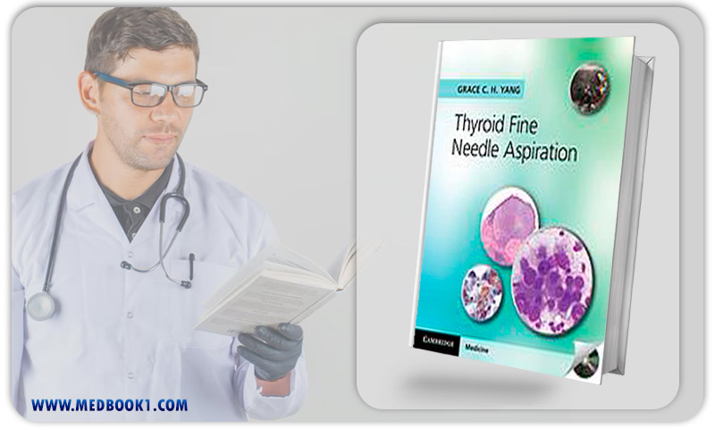 Thyroid Fine Needle Aspiration (Original PDF from Publisher)