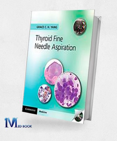 Thyroid Fine Needle Aspiration (Original PDF from Publisher)