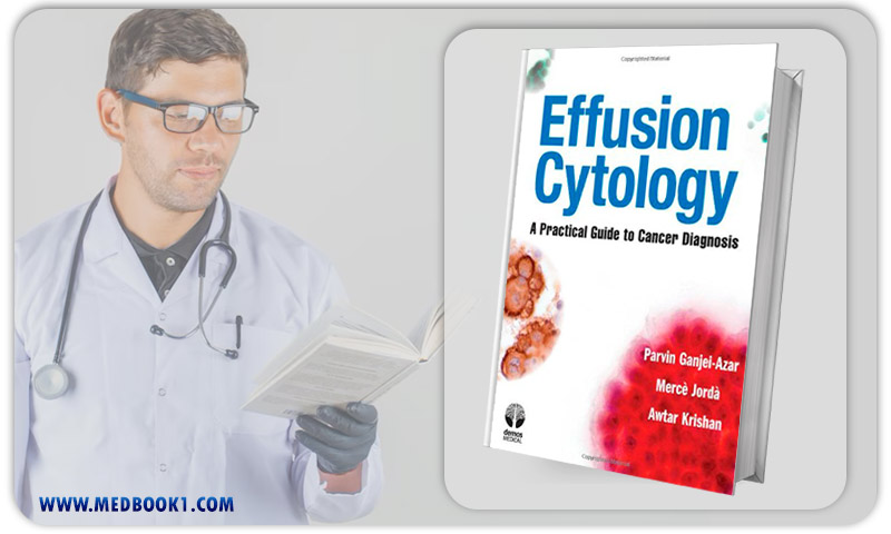 Effusion Cytology A Practical Guide to Cancer Diagnosis (Original PDF from Publisher)