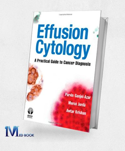 Effusion Cytology A Practical Guide to Cancer Diagnosis (Original PDF from Publisher)