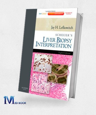 Scheuers Liver Biopsy Interpretation 8e (Original PDF from Publisher)