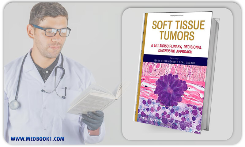 Soft Tissue Tumors A Multidisciplinary Decisional Diagnostic Approach (Original PDF from Publisher)