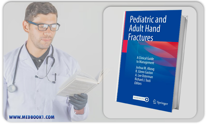 Pediatric and Adult Hand Fractures (EPUB)