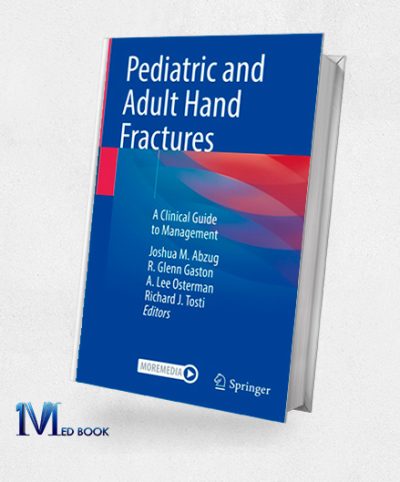 Pediatric and Adult Hand Fractures (Original PDF from Publisher)