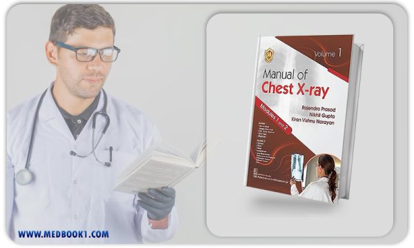 Manual of Chest Xray Volume 1