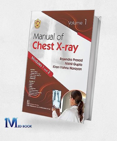 Manual of Chest Xray Volume 1