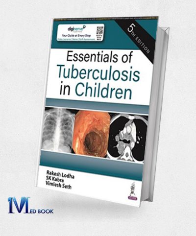 Essentials of Tuberculosis in Children