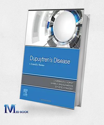 Dupuytrens Disease A Scientific Review (EPUB)