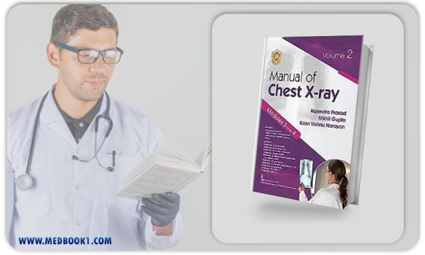 Manual of Chest Xray Volume 2