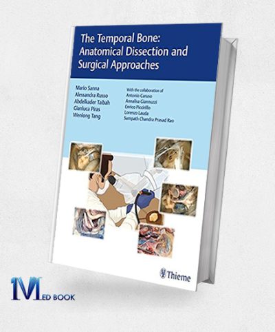 The Temporal Bone Anatomical Dissection And Surgical Approaches