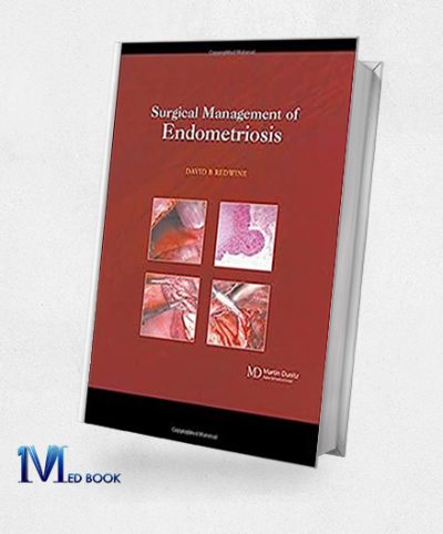 Surgical Management of Endometriosis