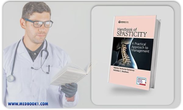 Handbook of Spasticity
