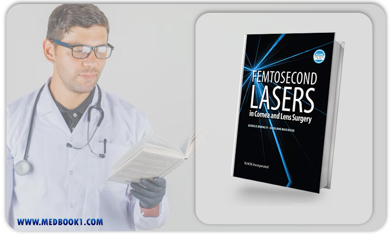 Femtosecond Lasers in Cornea and Lens Surgery (Original PDF from Publisher)