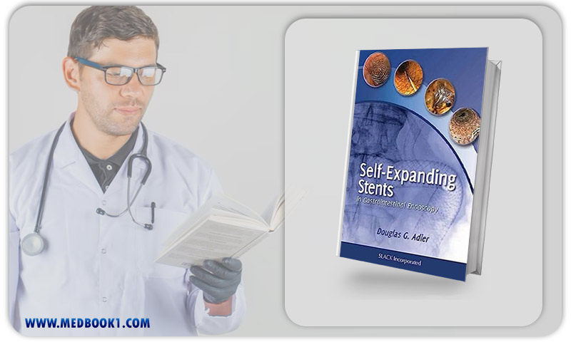 Self Expanding Stents In Gastrointestinal Endoscopy (Original PDF From Publisher)