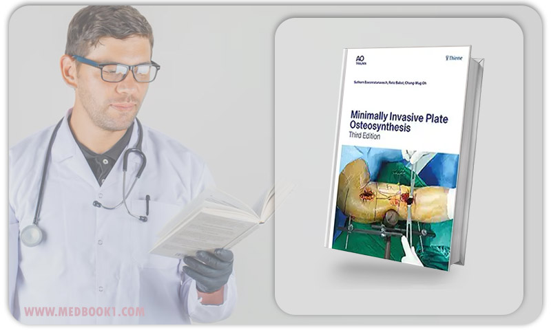 Minimally Invasive Plate Osteosynthesis (AO-Publishing), 3rd edition (ePub+Converted PDF)