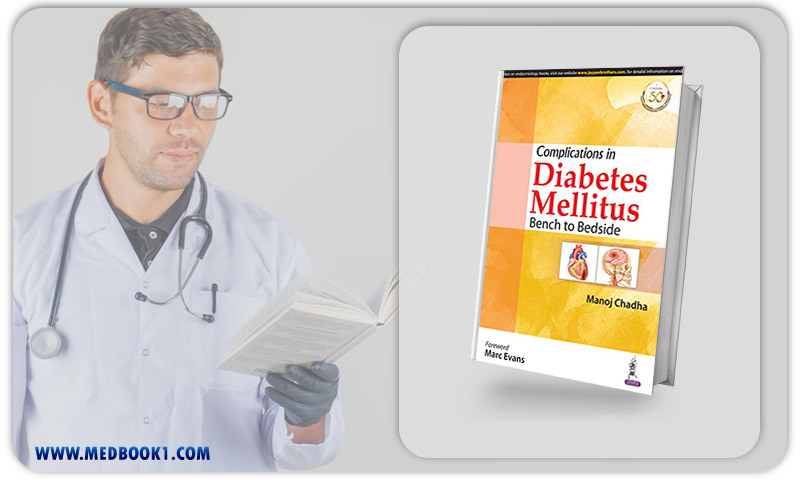 Complications in Diabetes Mellitus Bench to Bedside (Original PDF from Publisher)