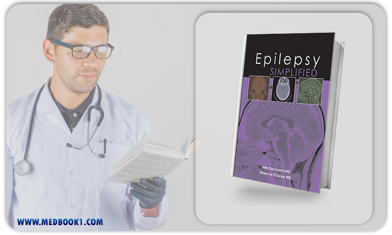 Epilepsy Simplified (EPUB)