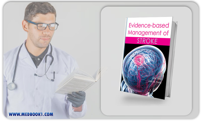Evidence-based Management of Stroke (EPUB)