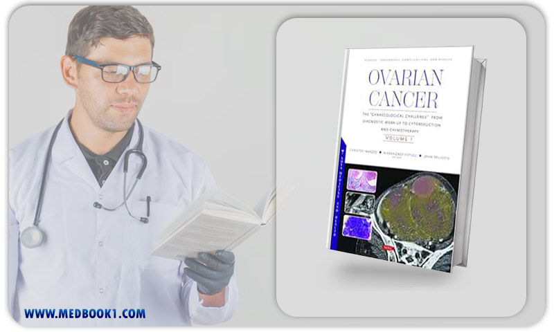 Ovarian Cancer: The “Gynaecological Challenge” From Diagnostic Work-Up To Cytoreduction And Chemotherapy. Volume 1 (Original PDF From Publisher)