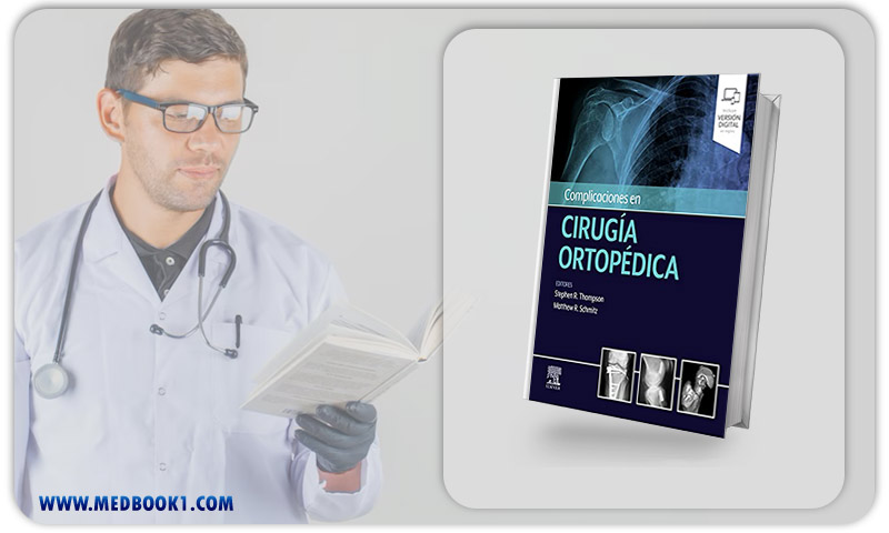 Complicaciones en cirugía ortopédica Medicina deportiva (Original PDF from Publisher)