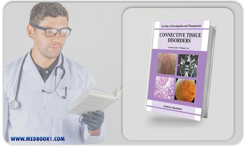 Connective Tissue Disorders An Atlas of Investigation and Management (Original PDF from Publisher)