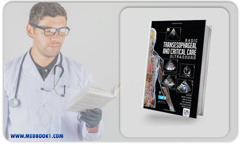 Basic Transesophageal and Critical Care Ultrasound (Original PDF from Publisher)