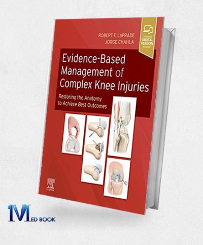 Evidence-Based Management of Complex Knee Injuries Restoring the Anatomy to Achieve Best Outcomes (True PDF)