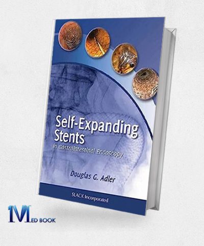 Self Expanding Stents In Gastrointestinal Endoscopy (Original PDF From Publisher)