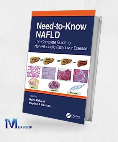 Need-To-Know NAFLD The Complete Guide To Nonalcoholic Fatty Liver Disease (Original PDF From Publisher)