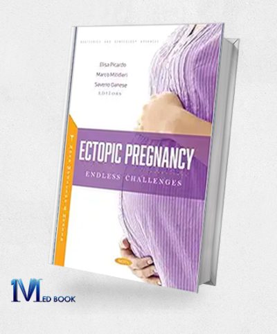 Ectopic Pregnancy Endless Challenges (Original PDF From Publisher)