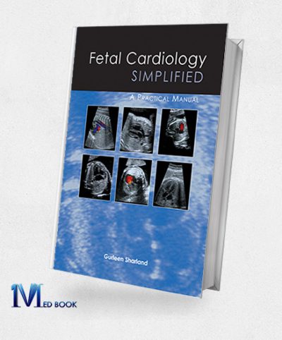 Fetal Cardiology Simplified (EPUB)