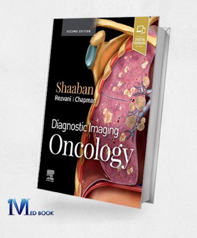 Diagnostic Imaging Oncology , 2nd Edition (EPUB)
