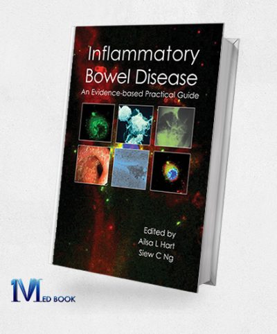 Inflammatory Bowel Disease (EPUB)