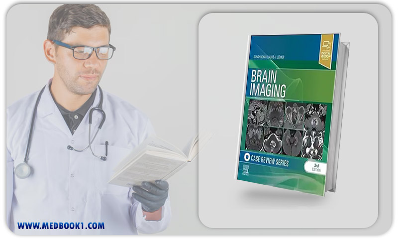 Brain Imaging: Case Review Series, 3rd Edition (Original PDF From Publisher)