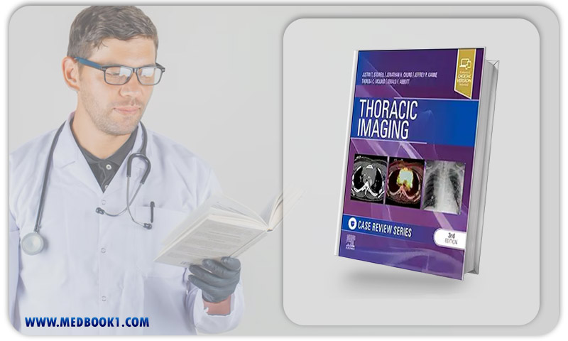 Thoracic Imaging: Case Review, 3rd Edition (Original PDF From Publisher)