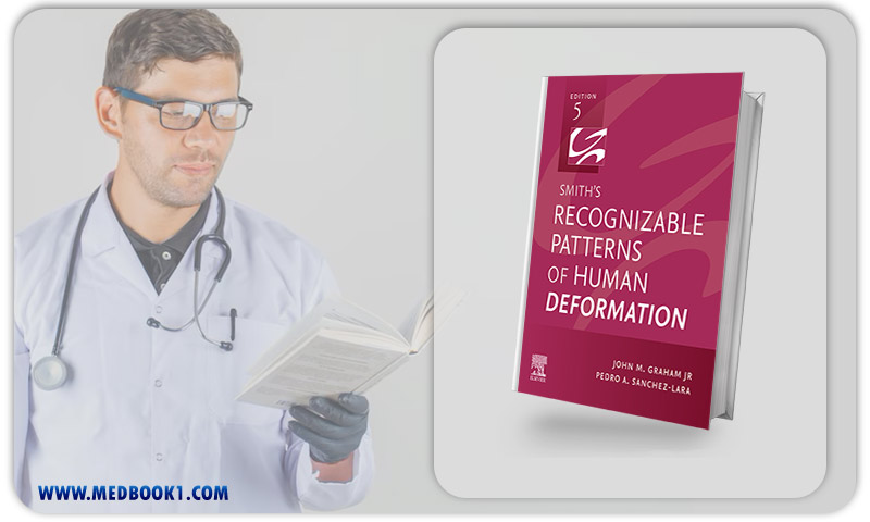 Smith’s Recognizable Patterns Of Human Deformation, 5th Edition (EPub+Converted PDF)