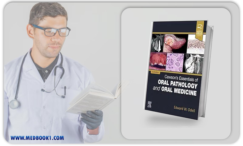 Cawson’s Essentials Of Oral Pathology And Oral Medicine, 10th Edition (EPub+Converted PDF)