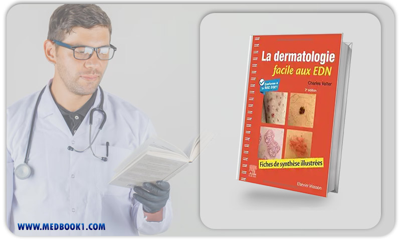 La Dermatologie Facile Aux EDN: Fiches De Synthèse Illustrées, 2nd Edition (Original PDF From Publisher)