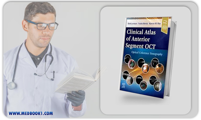 Clinical Atlas Of Anterior Segment OCT: Optical Coherence Tomography (True PDF)