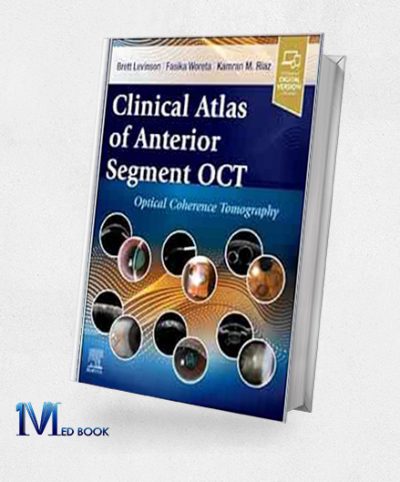 Clinical Atlas Of Anterior Segment OCT: Optical Coherence Tomography (True PDF)