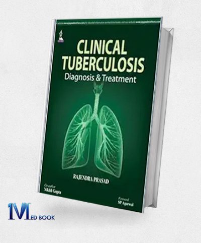 Clinical Tuberculosis: Diagnosis & Treatment: Diagnosis And Treatment (Original PDF From Publisher)