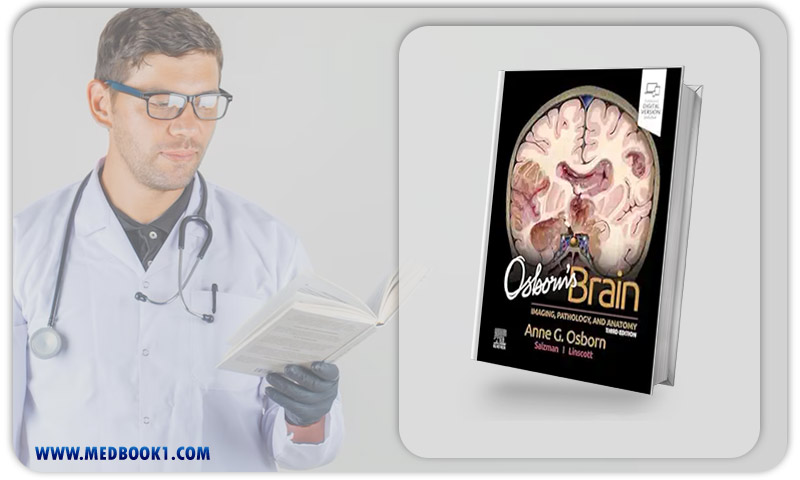 Osborn’s Brain, 3rd Edition (EPub+Converted PDF)